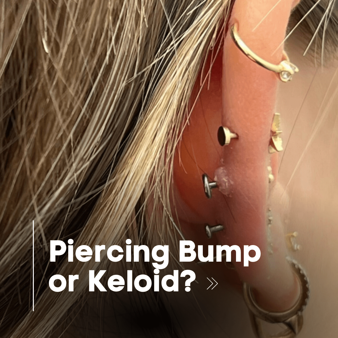 Understanding The Difference Between Piercing Bumps And Keloids Lulu Ave